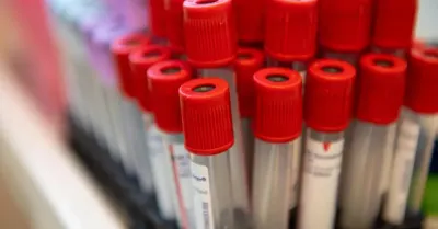 Zbyt wysoki cholesterol ma 21 mln Polaków – rusza kampania „Cholesterol. Poznaj swoje liczby”